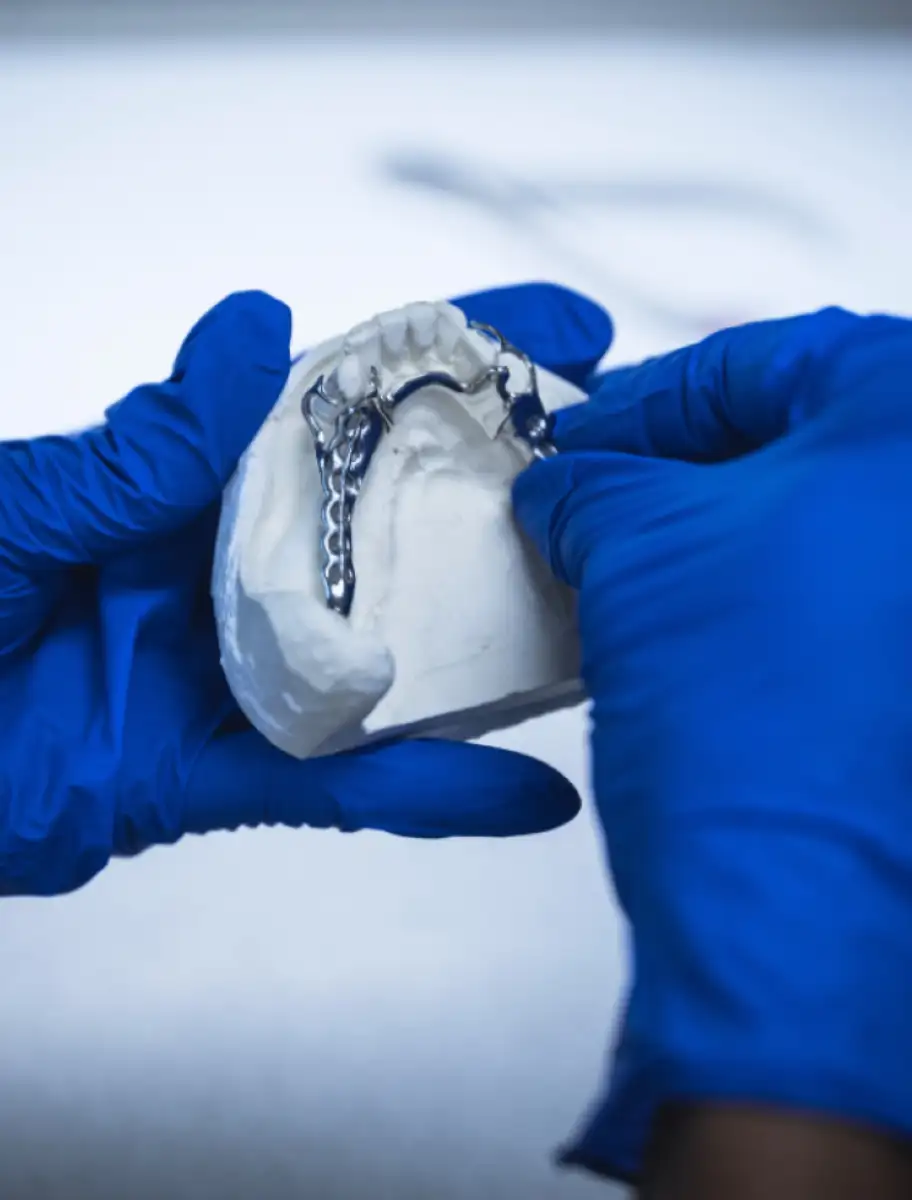 Mains qui placent un dentier sur un moule